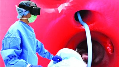 أشعة VR حل جديد لعلاج للجلطات والسرطانات