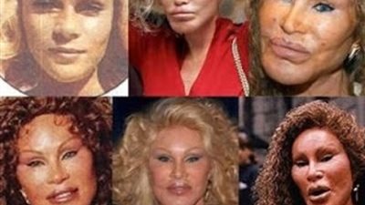10 مشاهير شوهتهم عمليات التجميل بعد انفاق الاف الدولارات