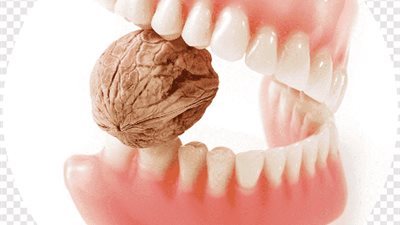 أحذر المعجون.. قد يتسبب فى تلف طقم الأسنان
