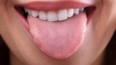 دراسة تكشف عن خطر قاتل للبقع الظاهرة على لسان الإنسان