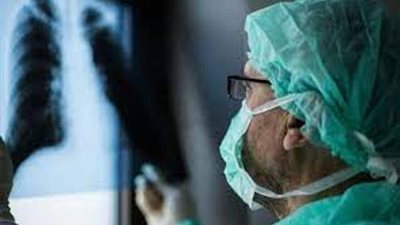 احذروا الجلطات ... أطباء الأوعية الدموية يحذرون مرضى 