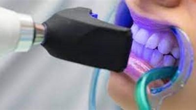 ما حكم تبييض الأسنان بالليزر؟
