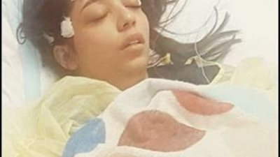إصابة فنانة مشهورة بمرض خطير فى الرأس.. ونقلها للعلاج فى الخارج