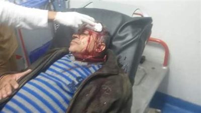 قطع فى شريان بالمخ لموظف أثناء إزالة مخالفات بحى المناخ