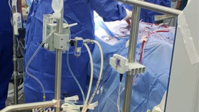 استمرار إجراء جراحات القلب المفتوح بمستشفي الزقازيق العام