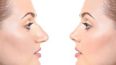 عملية تجميل الانف لا حرمة فيها اذا توافر لها هذا الشرط الاصيل