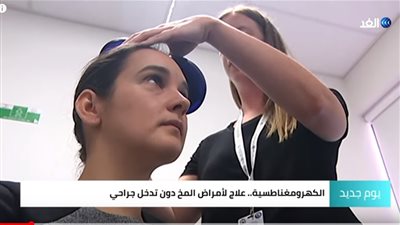 شاهد بالفيديو.. تقنية جديدة لعلاج أمراض المخ دون تدخل جراحي