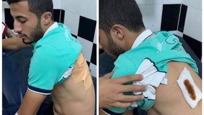 الاعتداء على لاعب الوداد المغربي بالسلاح الابيض قبل مواجهة الترجي