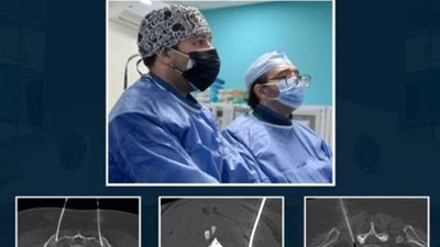 لأول مرة .. علاج الآلام بالأشعة التداخلية بمجمع الإسماعيلية الطبي