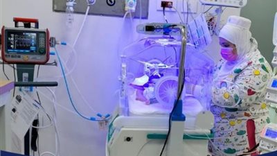 قسم حضانات مستشفى فايد التخصصي يتعامل بنجاح مع حالات مبتسرين شديدة الخطورة