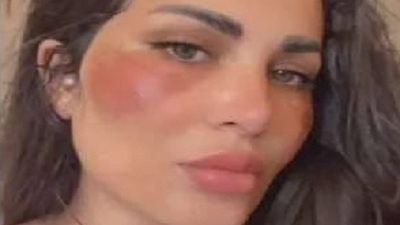 تفاصيل تعرض طليقة احمد الفيشاوى للحريق