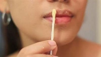 طرق علاج السواد حول الفم