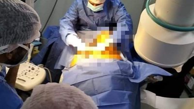 ولادة قصرية لسيده بمستشفي الغردقة خلال 7دقائق فقط