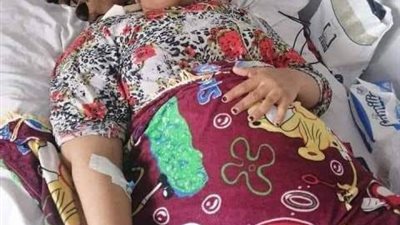التعدي على معلمة وإصابتها بجروح خطيرة فى البحيرة..«100 غرزة جراحية»