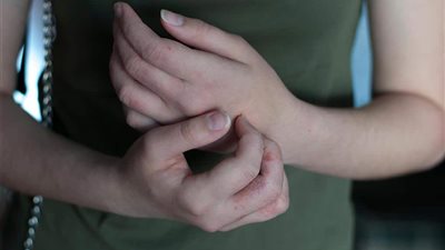 احذرمن الاصابة بهذه الأمراض الجلدية المعدية