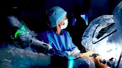 روبوت ينقذ حياة رجل عن طريق إزالة ورم سرطاني من حلقه
