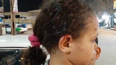 كلب ضال يعقر 8 أشخاص فى قرية بالبحيرة