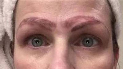 خضعت لعملية تجميل لحاجبيها.. فخرجت 