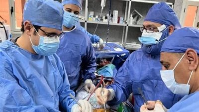 الاولى من نوعها.. نجاح تغيير الصمام الميترالي بمستشفيات جامعة بنها