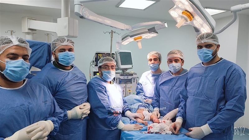 نجاح علاج تشوه وإعوجاج