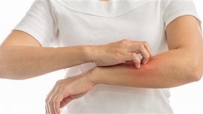 طفح وجفاف.. أبرز أعراض 