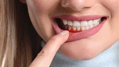 كيف تستخدم الماء كعلاج لآلام اللثة ؟ إليك طريقة مُجربة