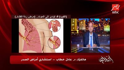 يؤدي إلى الموت.. مرض 