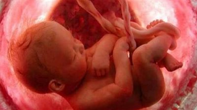سمنة الحوامل تؤدي إلى تغيير بنية ووظيفة المشيمة