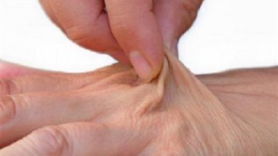 احذر الإصابة الجفاف .. إليك 6 علامات مبكرة
