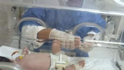 فحص ٢٦ ألف طفل بالمبادرة الرئاسية للكشف عن أمراض الأطفال