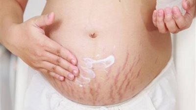 3 طرق للتخلص من ترهلات البطن بعد الولادة