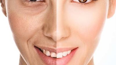 7 خطوات لعلاج التجاعيد قبل العيد