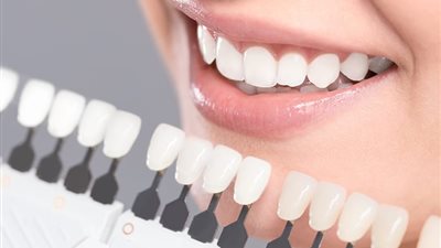 كل ما تود معرفته عن أنواع تجميل الأسنان