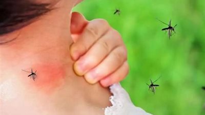الأسباب والأعراض وطرق الوقاية .. كل ما تريد معرفته عن حمى الضنك