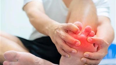 6 خطوات لعلاج النقرس بدون ادوية