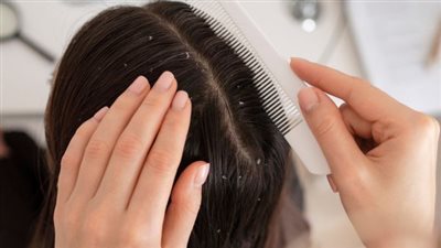 افضل طريقة لغسل فرشاة شعرك إذا كنت تعاني من القشرة
