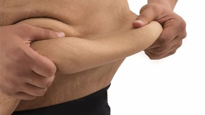 8 اسباب لترهل الجلد وتمارين هامة لشده