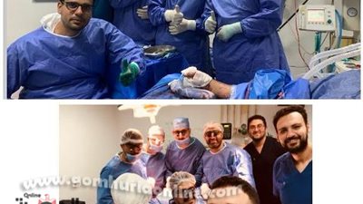 فريـق جراحة التجميل بطب المنوفية ينجح فـي إعادة يـد مبتورة للحركة