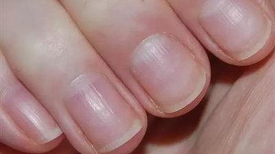 8 خطوات لاظافر قوية..تعرف عليها