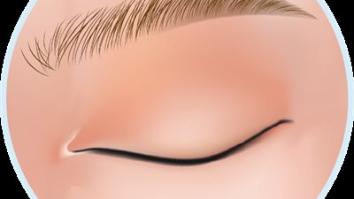 مشروعية عمليات تجميل رفع الحواجب